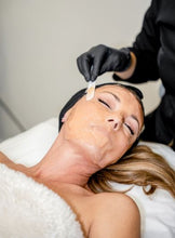 Load image into Gallery viewer, CO2 Pro Lift Mask - Carboxy Rejuvenating Skin Treatment Kit

