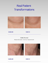 Load image into Gallery viewer, ZO® Neck Complex
